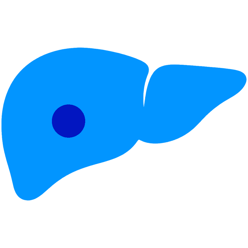 肝癌